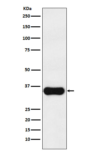 MC1R Rabbit mAb