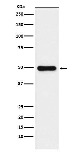 Glutathione Synthetase Rabbit mAb