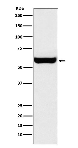 Monoamine Oxidase A Rabbit mAb