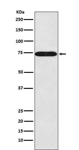 SNX1 Rabbit mAb