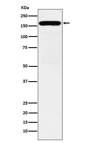 DIAPH1 Rabbit mAb