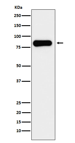 Aconitase 2 Rabbit mAb