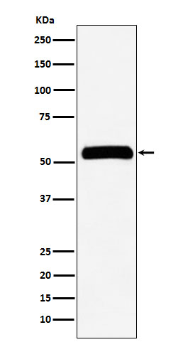 IMPDH2 Rabbit mAb