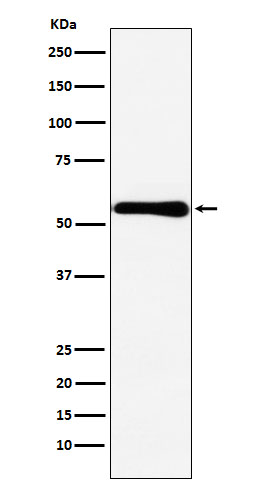 CBS Rabbit mAb