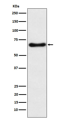 Cytochrome P450 24A1 Rabbit mAb