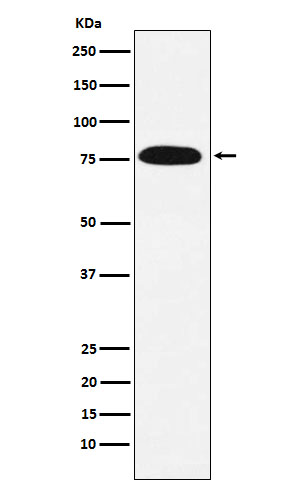 KHSRP Rabbit mAb