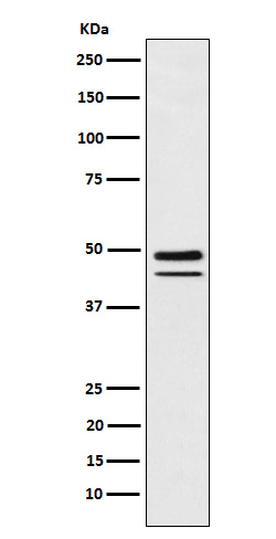 T Box Transcription Factor T Rabbit mAb