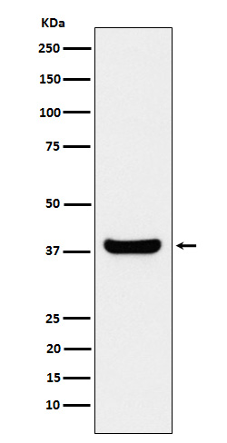 PP1C beta Rabbit mAb