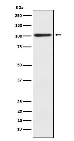 Sarcomeric alpha Actinin Rabbit mAb