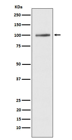 SERCA1 ATPase Rabbit mAb