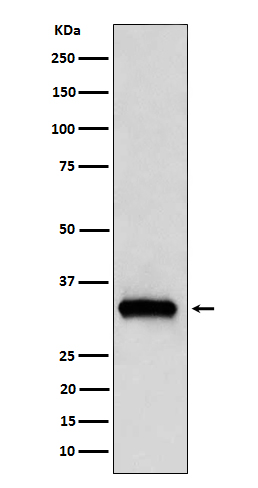 NDUFAF1 Rabbit mAb