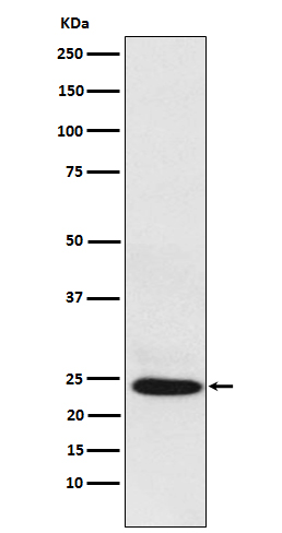 BAG2 Rabbit mAb