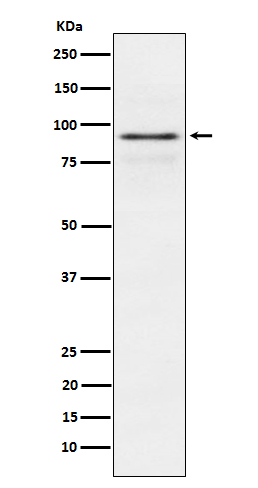 RSK1 p90 Rabbit mAb