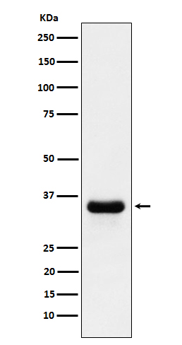 PSMD14 Rabbit mAb