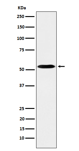 PKA RII alpha Rabbit mAb