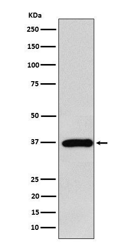 FBP1 Rabbit mAb