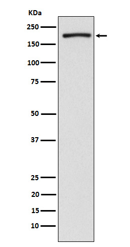 EHMT2 Rabbit mAb