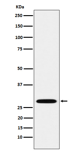 PSMA3 Rabbit mAb