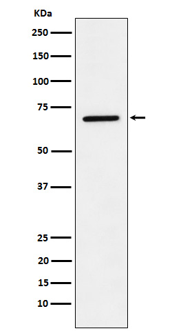 Leukotriene A4 Hydrolase Rabbit mAb