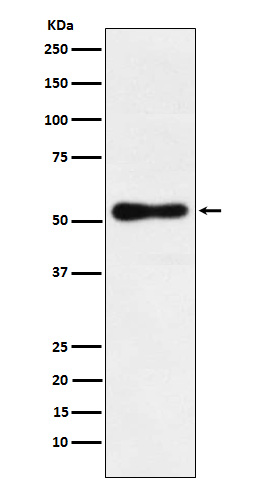 RORB Rabbit mAb