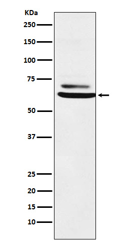 ENT2 Rabbit mAb