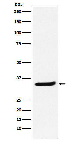 RNA Polymerase II Subunit B3 Rabbit mAb