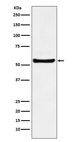 PAR2 Rabbit mAb