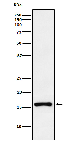 CDKN2C Rabbit mAb