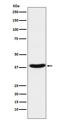 MT ND1 Rabbit mAb