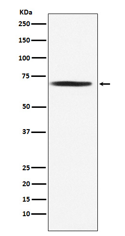 Pyruvate Dehydrogenase E2 Rabbit mAb