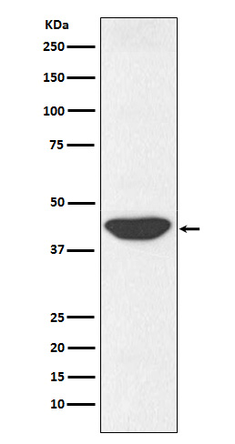 IDH1 Rabbit mAb