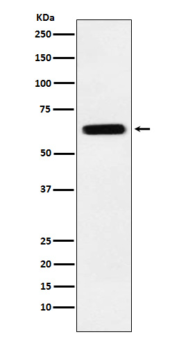 CRMP5 Rabbit mAb