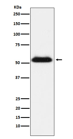 Transmembrane Protease Serine 2 Rabbit mAb