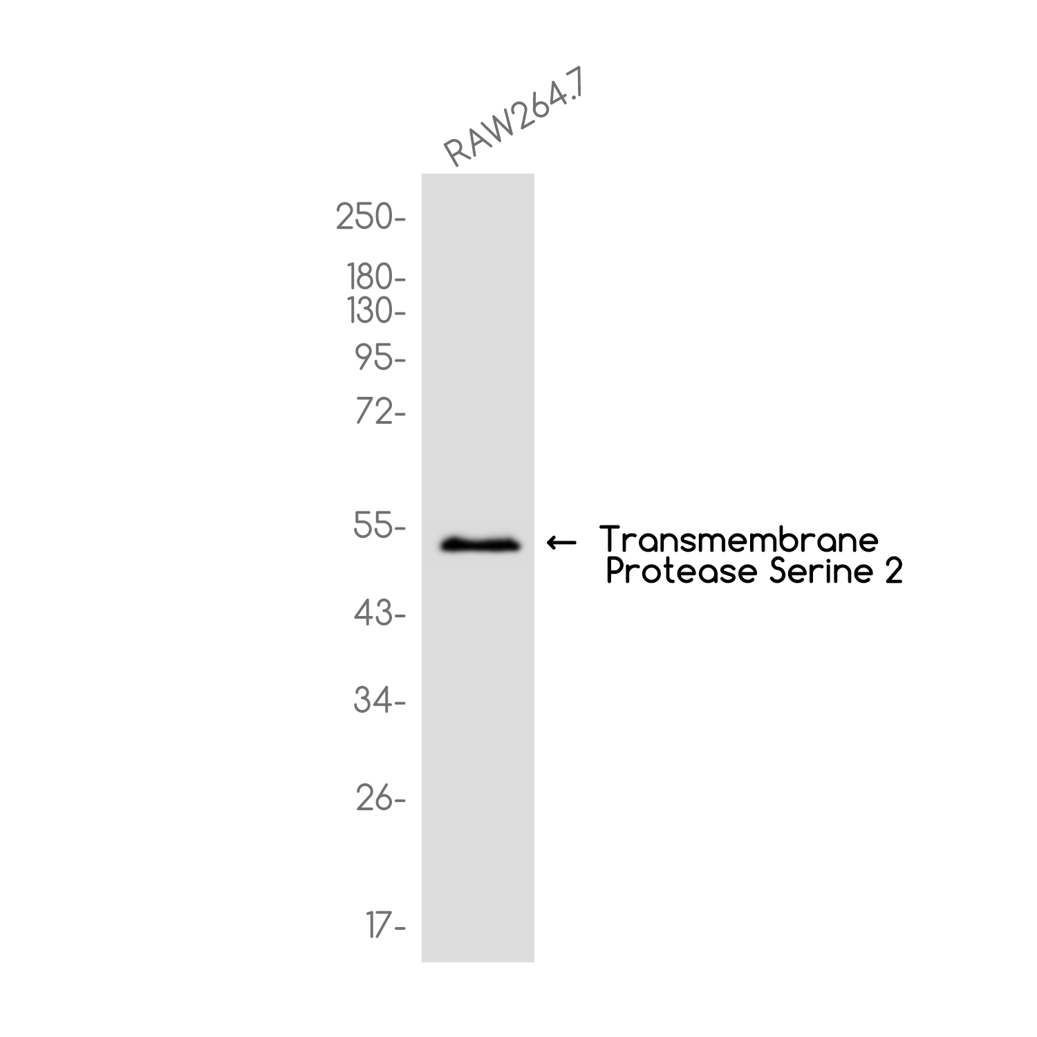 Transmembrane Protease Serine 2 Rabbit mAb