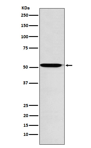 Activin A Receptor Type IB Rabbit mAb