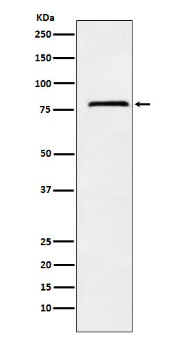 NDUFS1 Rabbit mAb