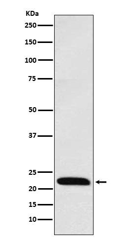 ICOS Rabbit mAb