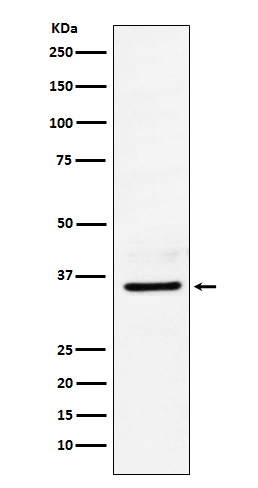 Lactate Dehydrogenase B Rabbit mAb