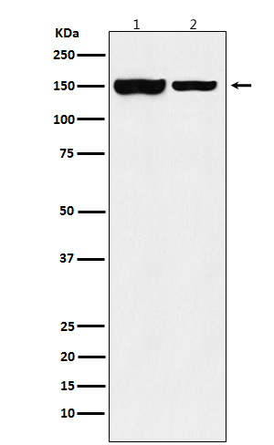 KDM4B Rabbit mAb