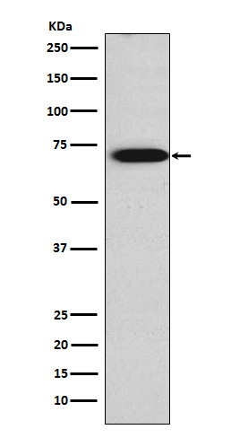 TRIM29 Rabbit mAb