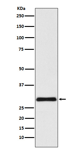 VPS24 Rabbit mAb