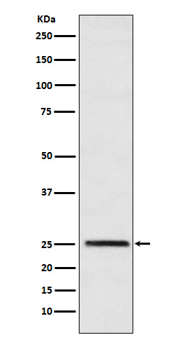 Triosephosphate Isomerase Rabbit mAb