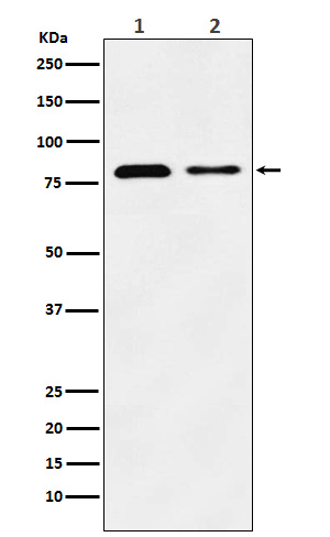 Lysosome Membrane Protein 2 Rabbit mAb