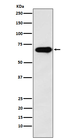 SAM68 Rabbit mAb