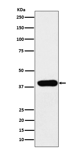 Adenosine Deaminase Rabbit mAb