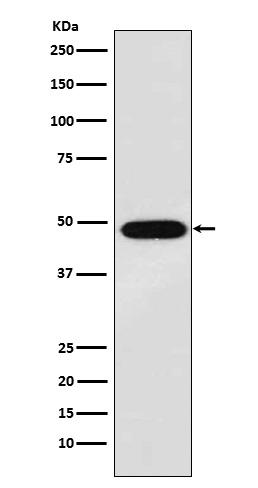 MAGE1 Rabbit mAb