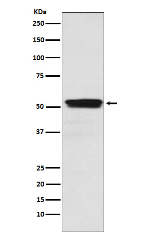 Muscarinic Acetylcholine Receptor M2 Rabbit mAb