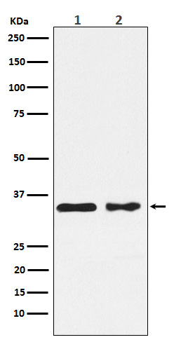 CSNK1A1 Rabbit mAb