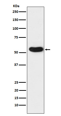 Nicotinic Acetylcholine Receptor alpha 5 Rabbit mAb