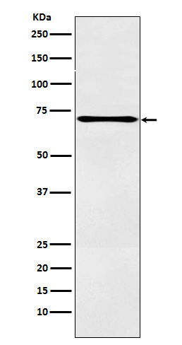 12 Lipoxygenase Rabbit mAb